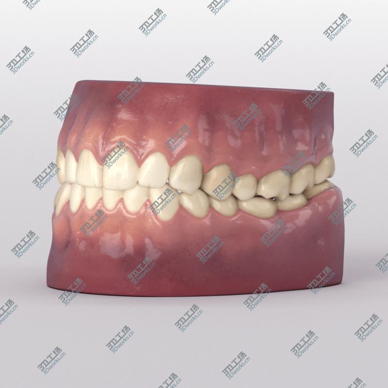 images/goods_img/202104092/Teeth With Roots And Gums 3D model/2.jpg